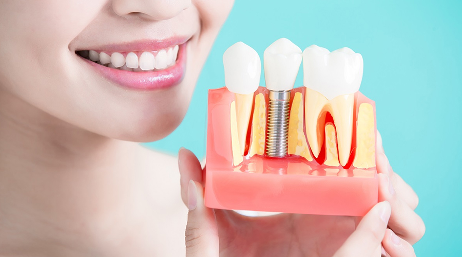Best Dental Implants Specialist In Paschim Vihar – Find A Specialist
